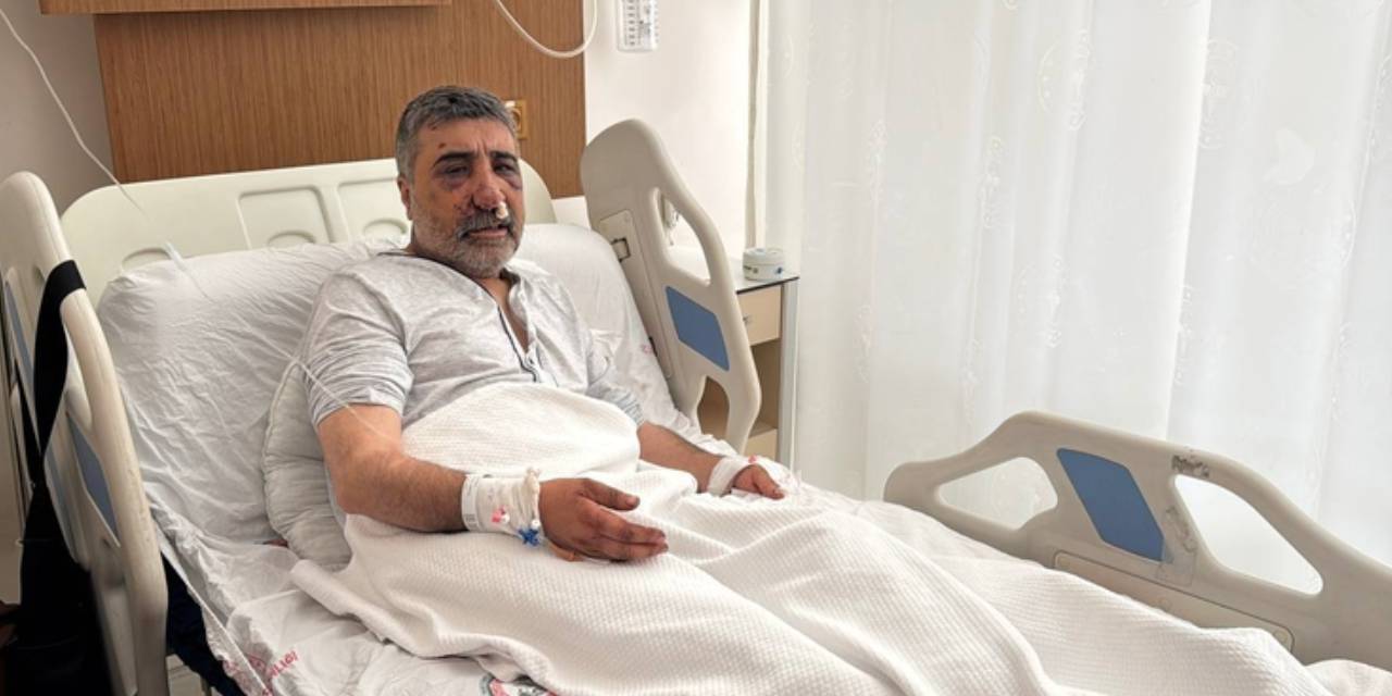 ingiliz boksorun darp ettigi taksicinin davasi goruldu geceleri bagirarak uyaniyorum mmrO665B.jpg